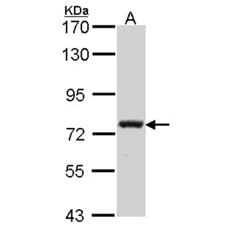 Calpain 5 antibody from Signalway Antibody (22798) - Antibodies.com