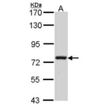 Calpain 5 antibody from Signalway Antibody (22798) - Antibodies.com