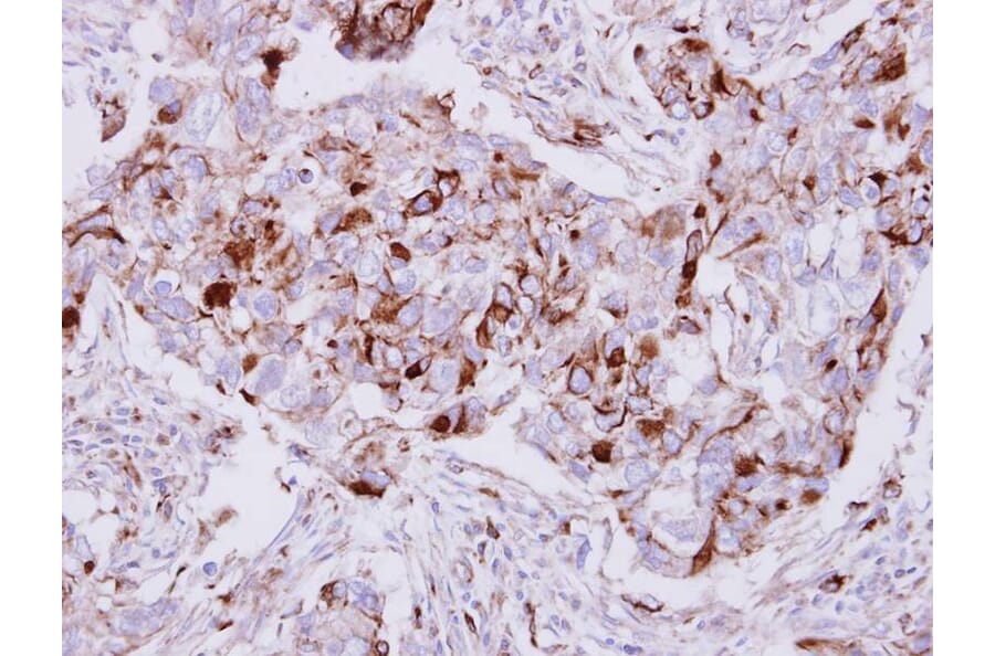 Immunohistochemistry - Calpain 5 antibody from Signalway Antibody (22798) - Antibodies.com