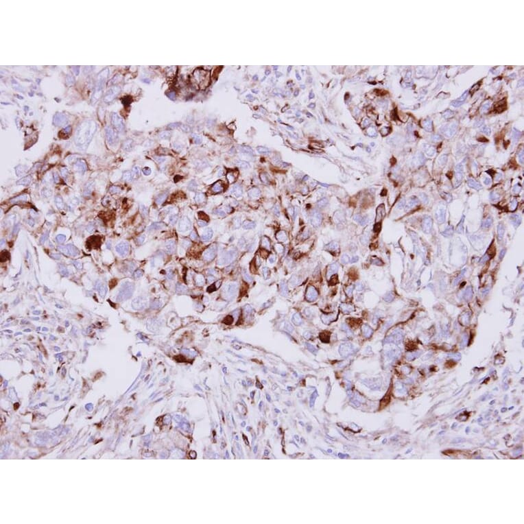 Immunohistochemistry - Calpain 5 antibody from Signalway Antibody (22798) - Antibodies.com