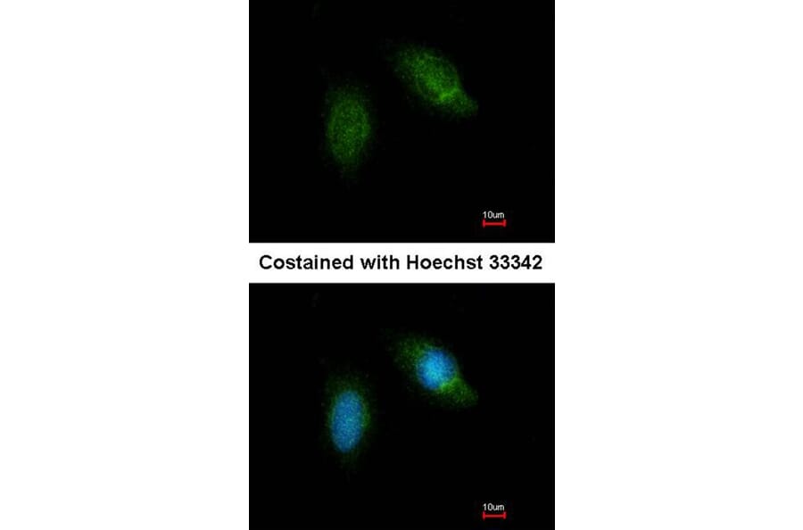 Immunofluorescence - Calpain 5 antibody from Signalway Antibody (22798) - Antibodies.com
