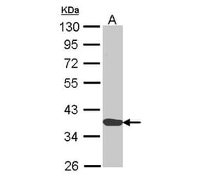 Annexin A1 antibody from Signalway Antibody (22818) - Antibodies.com