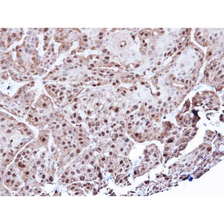 Immunohistochemistry - Annexin A1 antibody from Signalway Antibody (22818) - Antibodies.com