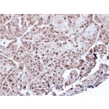 Immunohistochemistry - Annexin A1 antibody from Signalway Antibody (22818) - Antibodies.com