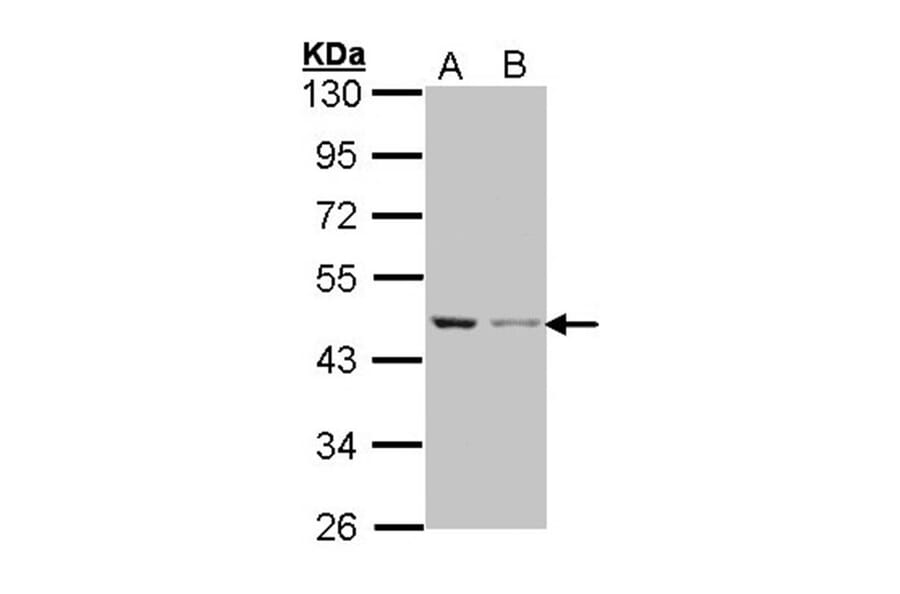 Beta Actin antibody from Signalway Antibody (22957) - Antibodies.com