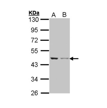 Beta Actin antibody from Signalway Antibody (22957) - Antibodies.com