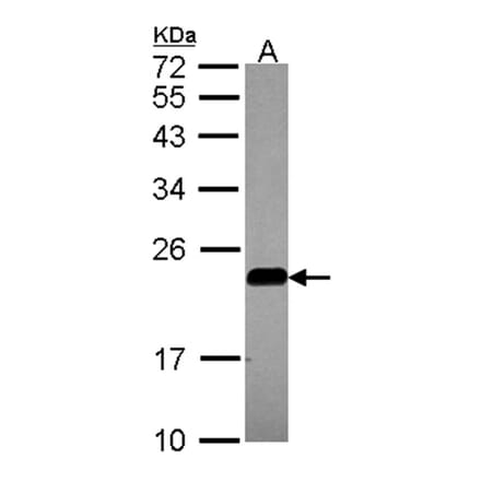 caveolin-2 antibody from Signalway Antibody (22980) - Antibodies.com