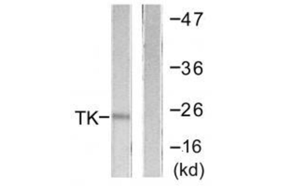 Western blot - TK (Ab-13) Antibody from Signalway Antibody (33143) - Antibodies.com