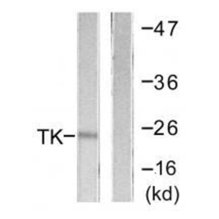 Western blot - TK (Ab-13) Antibody from Signalway Antibody (33143) - Antibodies.com