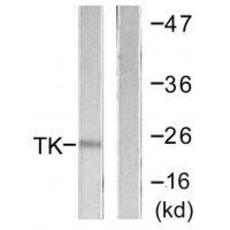 Western blot - TK (Ab-13) Antibody from Signalway Antibody (33143) - Antibodies.com