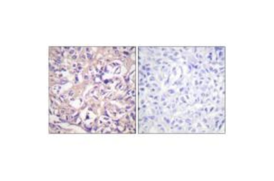 Immunohistochemistry - TK (Ab-13) Antibody from Signalway Antibody (33143) - Antibodies.com