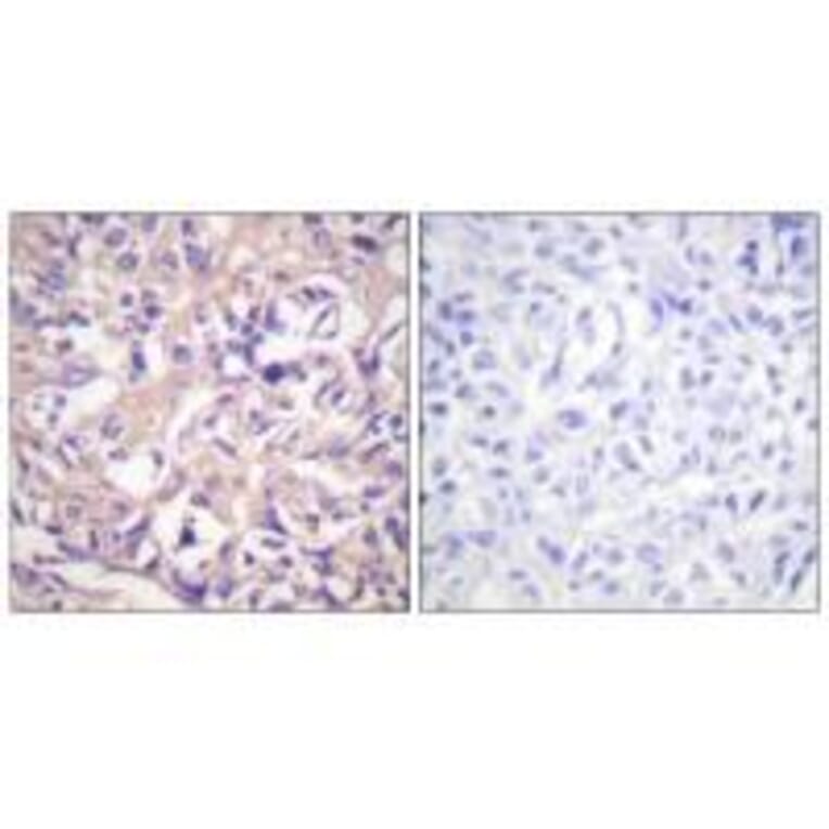 Immunohistochemistry - TK (Ab-13) Antibody from Signalway Antibody (33143) - Antibodies.com