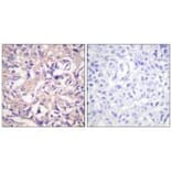 Immunohistochemistry - TK (Ab-13) Antibody from Signalway Antibody (33143) - Antibodies.com