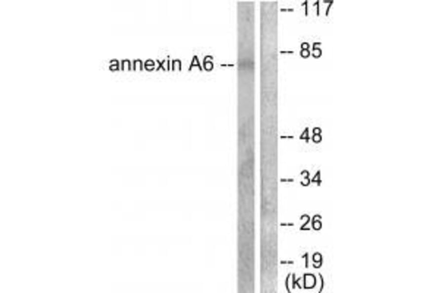 Western blot - Annexin A6 Antibody from Signalway Antibody (33322) - Antibodies.com