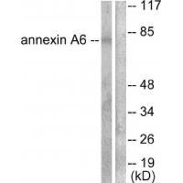 Western blot - Annexin A6 Antibody from Signalway Antibody (33322) - Antibodies.com