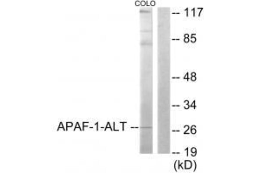 Western blot - APAF-1-ALT Antibody from Signalway Antibody (33324) - Antibodies.com