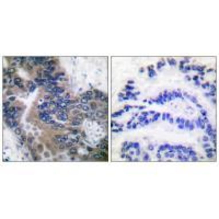 Immunohistochemistry - APAF-1-ALT Antibody from Signalway Antibody (33324) - Antibodies.com