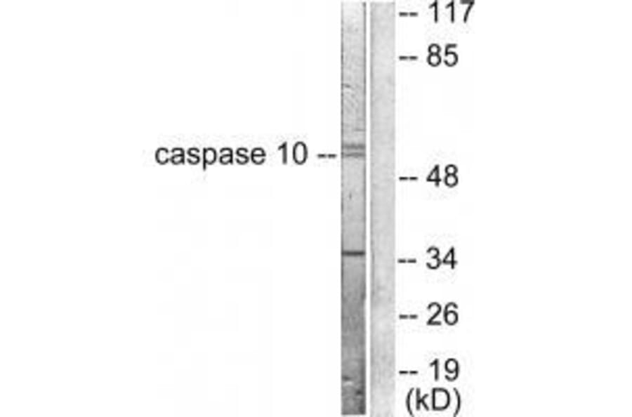 Western blot - Caspase 10 Antibody from Signalway Antibody (33328) - Antibodies.com