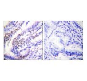 Immunohistochemistry - Cyclin E1 Antibody from Signalway Antibody (33351) - Antibodies.com