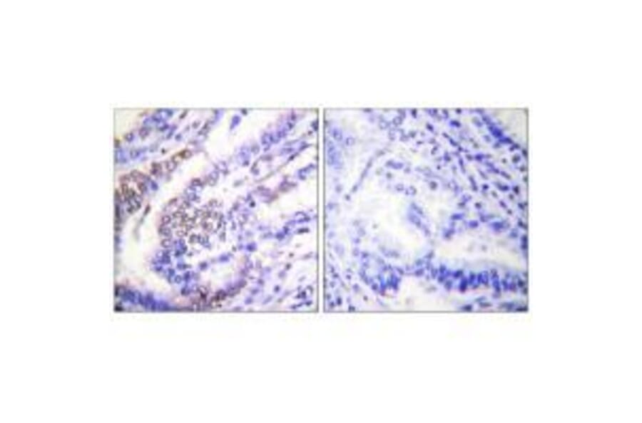 Immunohistochemistry - Cyclin E1 Antibody from Signalway Antibody (33351) - Antibodies.com