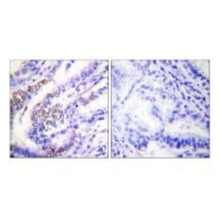 Immunohistochemistry - Cyclin E1 Antibody from Signalway Antibody (33351) - Antibodies.com