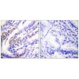 Immunohistochemistry - Cyclin E1 Antibody from Signalway Antibody (33351) - Antibodies.com