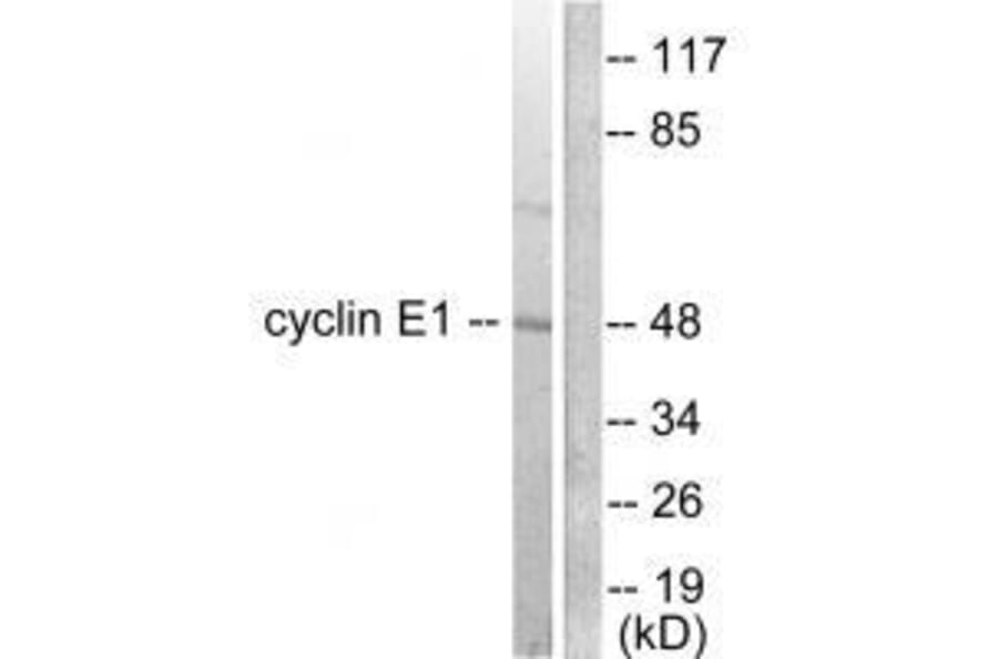 Western blot - Cyclin E1 Antibody from Signalway Antibody (33351) - Antibodies.com