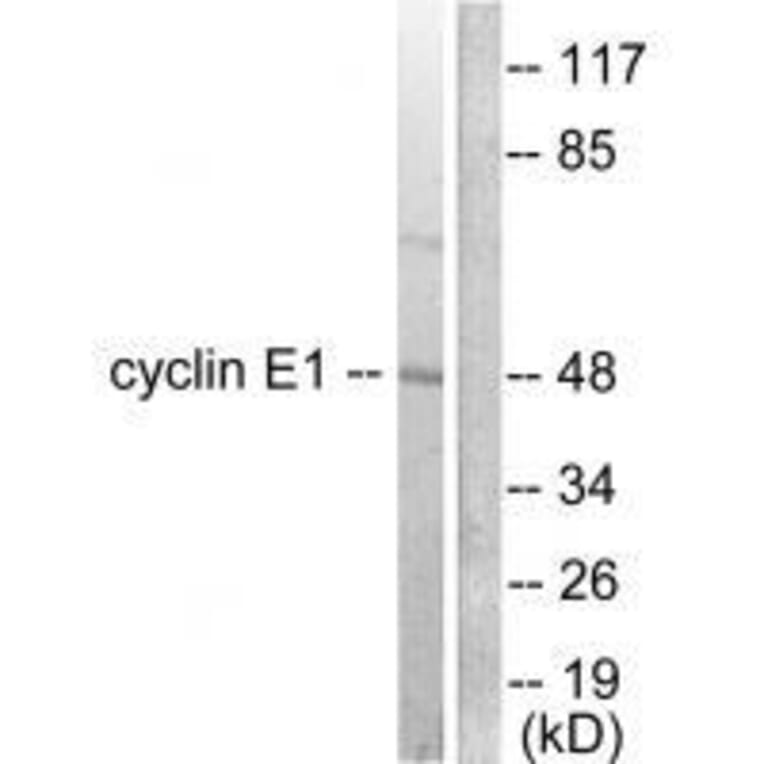 Western blot - Cyclin E1 Antibody from Signalway Antibody (33351) - Antibodies.com