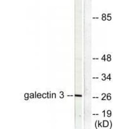 Western blot - Galectin 3 Antibody from Signalway Antibody (33382) - Antibodies.com