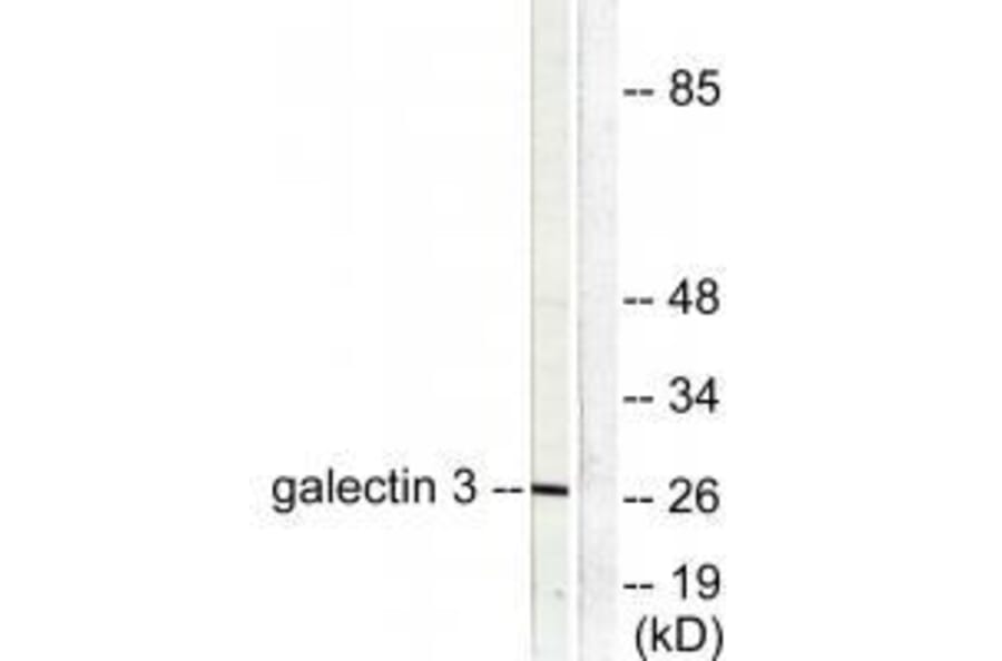 Western blot - Galectin 3 Antibody from Signalway Antibody (33382) - Antibodies.com