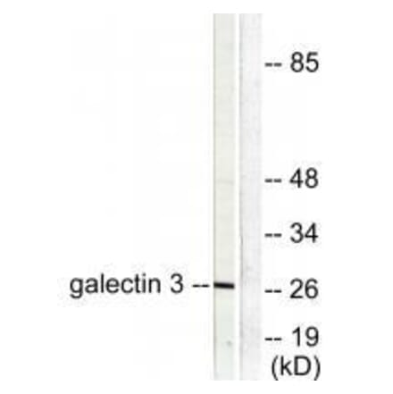 Western blot - Galectin 3 Antibody from Signalway Antibody (33382) - Antibodies.com