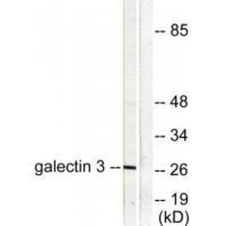 Western blot - Galectin 3 Antibody from Signalway Antibody (33382) - Antibodies.com