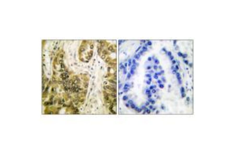 Immunohistochemistry - Galectin 3 Antibody from Signalway Antibody (33382) - Antibodies.com