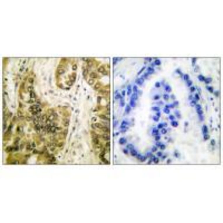 Immunohistochemistry - Galectin 3 Antibody from Signalway Antibody (33382) - Antibodies.com