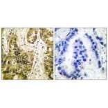 Immunohistochemistry - Galectin 3 Antibody from Signalway Antibody (33382) - Antibodies.com