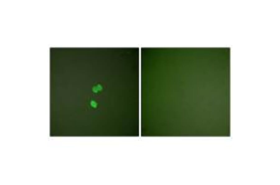 Immunofluorescence - Galectin 3 Antibody from Signalway Antibody (33382) - Antibodies.com