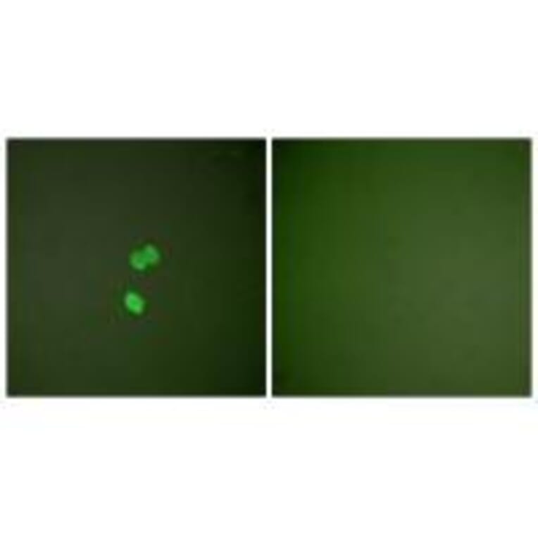 Immunofluorescence - Galectin 3 Antibody from Signalway Antibody (33382) - Antibodies.com
