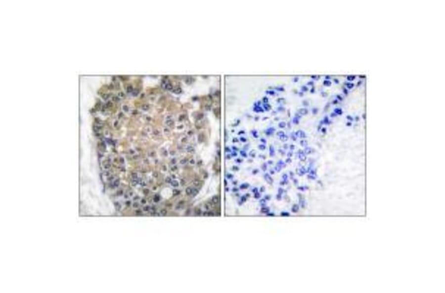 Immunohistochemistry - Keratin 17 Antibody from Signalway Antibody (33415) - Antibodies.com