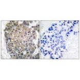 Immunohistochemistry - Keratin 17 Antibody from Signalway Antibody (33415) - Antibodies.com