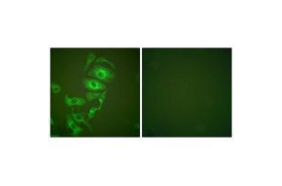 Immunofluorescence - Keratin 17 Antibody from Signalway Antibody (33415) - Antibodies.com