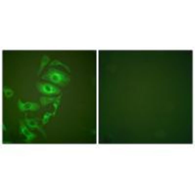 Immunofluorescence - Keratin 17 Antibody from Signalway Antibody (33415) - Antibodies.com
