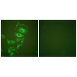 Immunofluorescence - Keratin 17 Antibody from Signalway Antibody (33415) - Antibodies.com