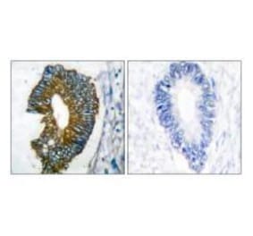 Immunohistochemistry - Keratin 18 Antibody from Signalway Antibody (33416) - Antibodies.com