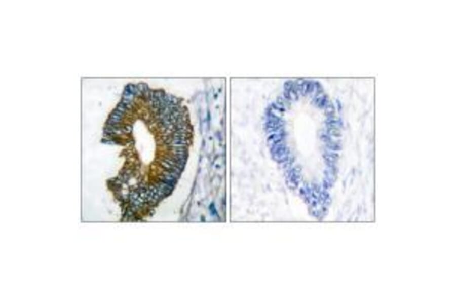 Immunohistochemistry - Keratin 18 Antibody from Signalway Antibody (33416) - Antibodies.com