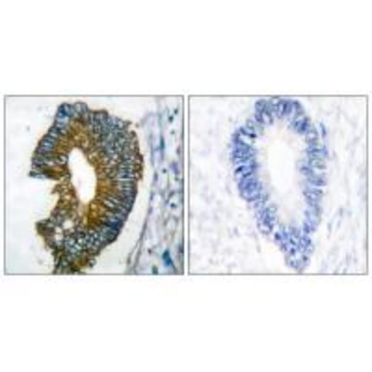 Immunohistochemistry - Keratin 18 Antibody from Signalway Antibody (33416) - Antibodies.com