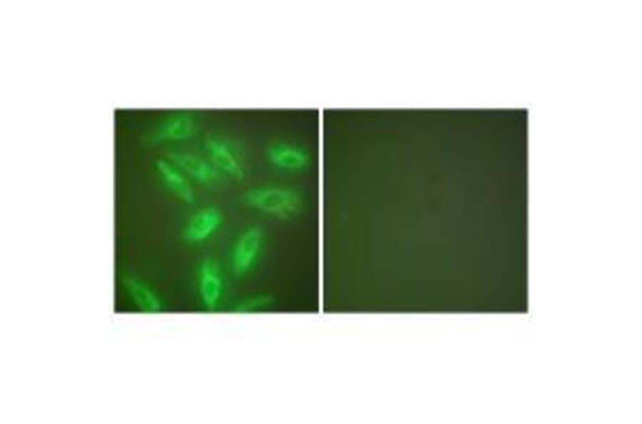 Immunofluorescence - Keratin 18 Antibody from Signalway Antibody (33416) - Antibodies.com