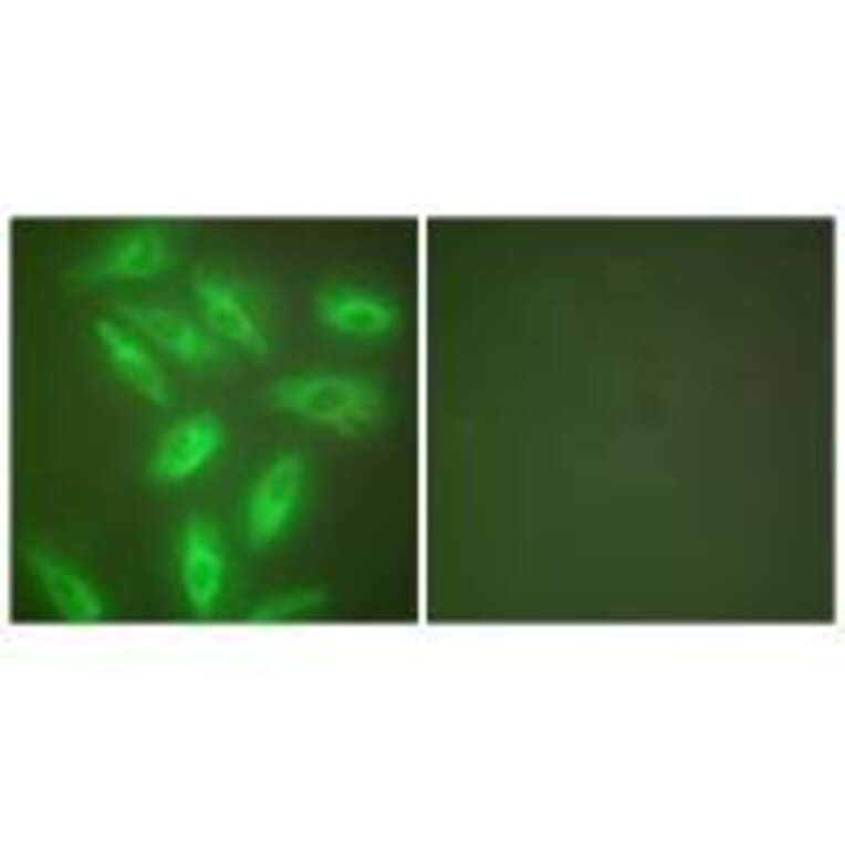 Immunofluorescence - Keratin 18 Antibody from Signalway Antibody (33416) - Antibodies.com