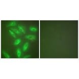 Immunofluorescence - Keratin 18 Antibody from Signalway Antibody (33416) - Antibodies.com