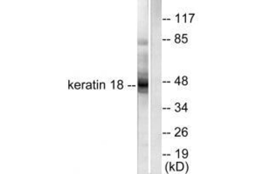Western blot - Keratin 18 Antibody from Signalway Antibody (33416) - Antibodies.com
