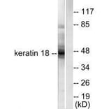 Western blot - Keratin 18 Antibody from Signalway Antibody (33416) - Antibodies.com
